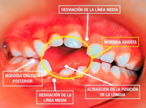 Los Chupetes Para Beb Pros Y Contras De Su Uso Hospital Del Ni o Dr Los Chupetes Para Beb Pros Y Contras De Su Uso Hospital Del Ni o Dr
